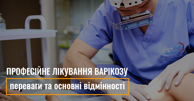 Професійне лікування варікозу