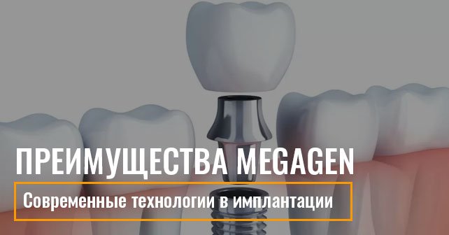преимущества системы MEGAGen