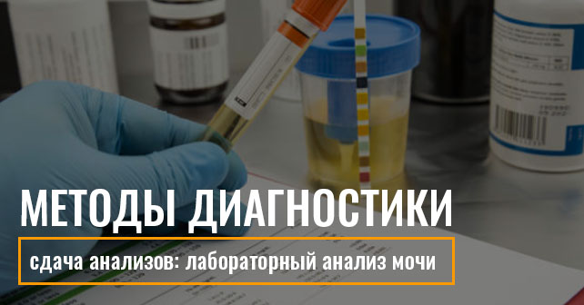 лабораторный анализ мочи