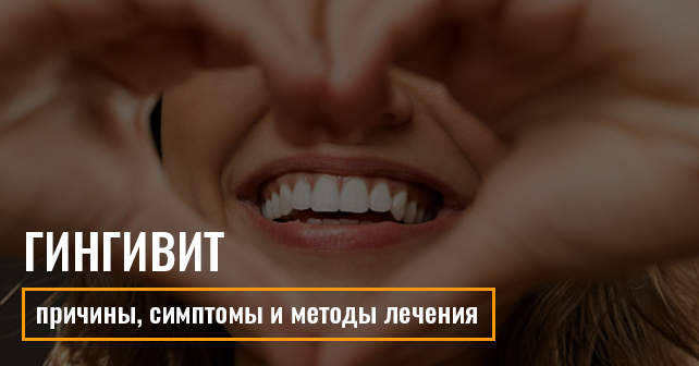 Гингивит: причины, симптомы и методы лечения