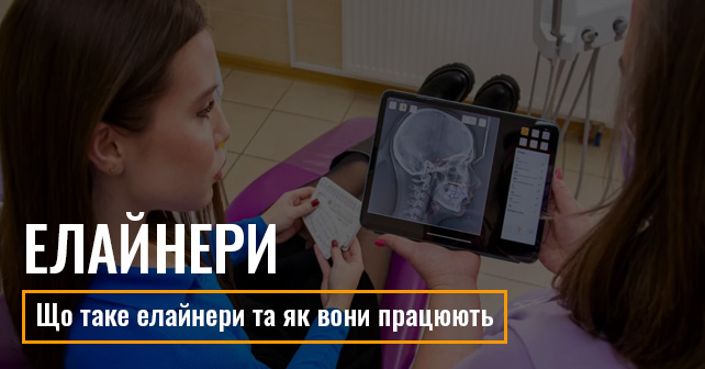 елайнери
