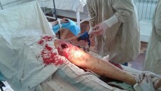 DRG wounded 2