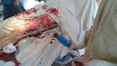 DRG wounded 3